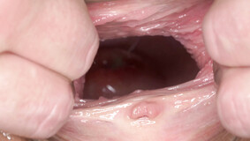 cervix
