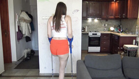 leg cast & sprained ankle