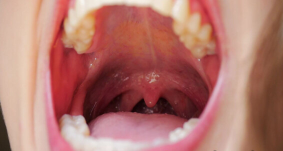 Coughing Fetish, Mouth Fetish, Throat Fetish, Tongue Fetish, Uvula Fetish madison marz mouth and uvula fetish ManyVids