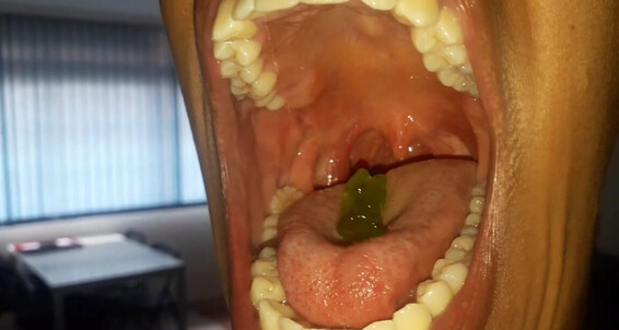 GoldenLace goes wild with Gummy Bear Swallow - Vore, Tongue and Mouth Fetish
