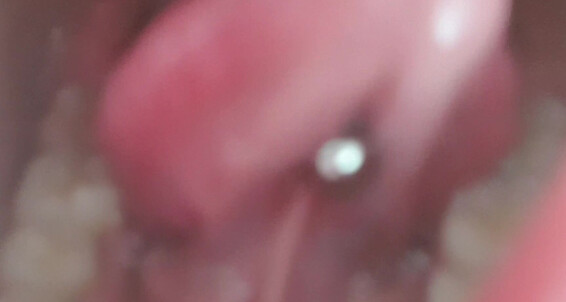 Sydneyharwin Vore Alert My Mouth Is Your Prison