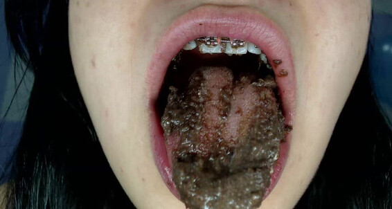 Braces,Food & Object Crush,Food Sploshing,Food Stuffing,Teeth,SFW miaisabella3 close up dirty ManyVids